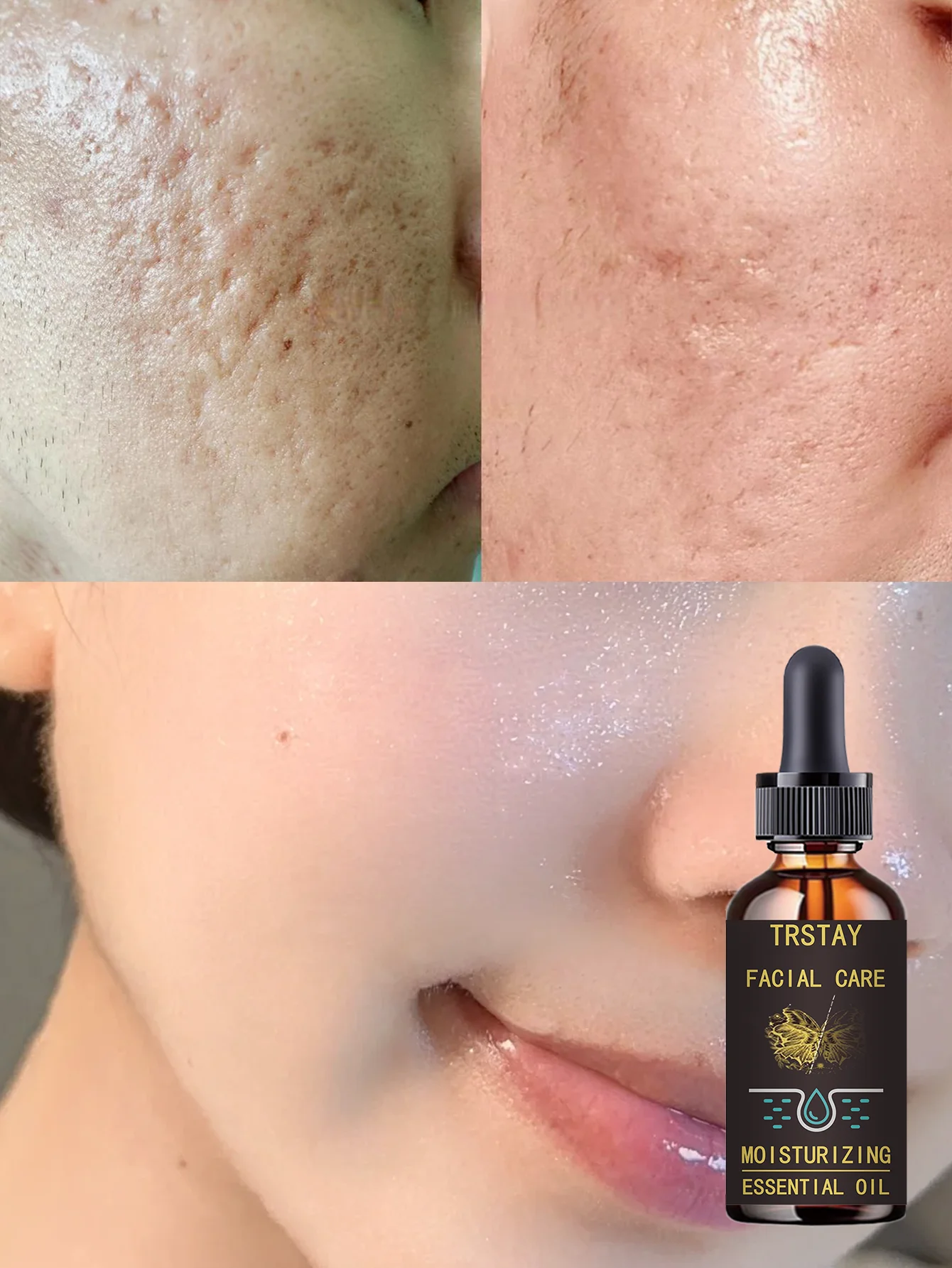 Deeply Moist Anti Wrinkle Essence Milk for Tender Skin with Whitening Benefits Hydration Treatment to Improve Skin Texture and P - Image 2