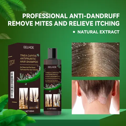 EELHOE Hair Cleaning Shampoo Anti Dandruff Remove Mites Relieve Itching Oil Control Scalp Cleaning Refreshing Hair Shampoo