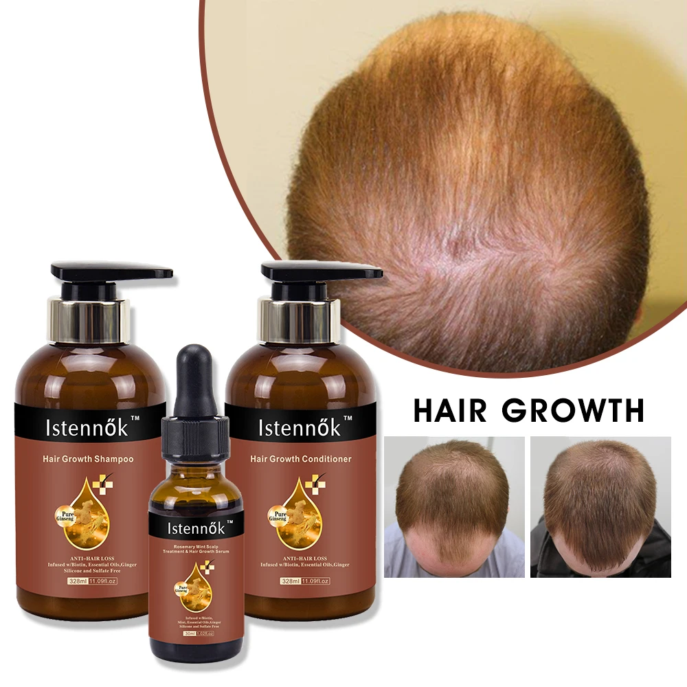 2023 Professional Hair Growth Products Shampoo And Conditioner Serum For Women Men Ginger Hair Regrowth Set Anti Hair Loss