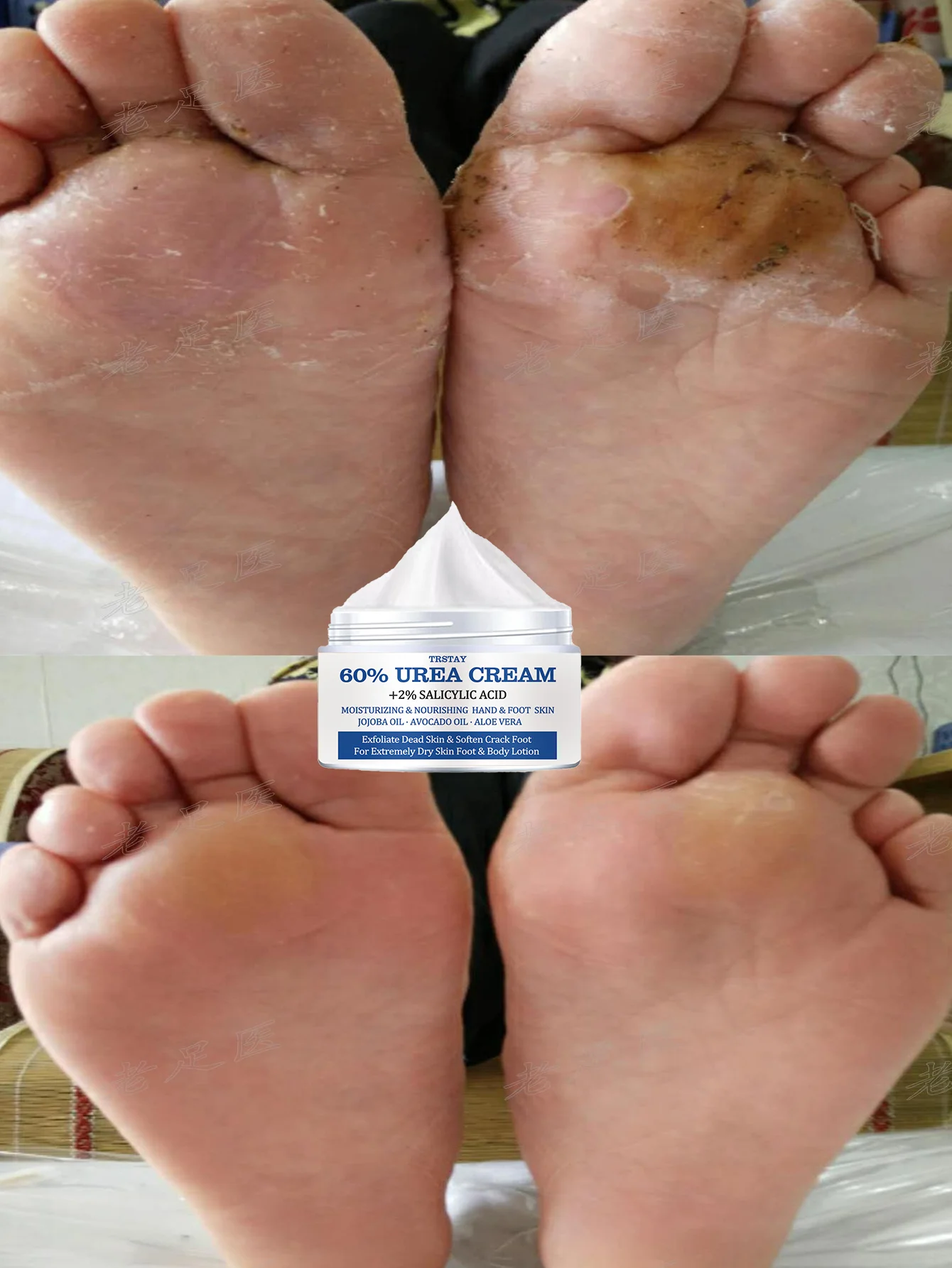 

Deep moisturizing foot cream repairs dry cracked heels provides long lasting hydration softens rough skin on soles for smooth so