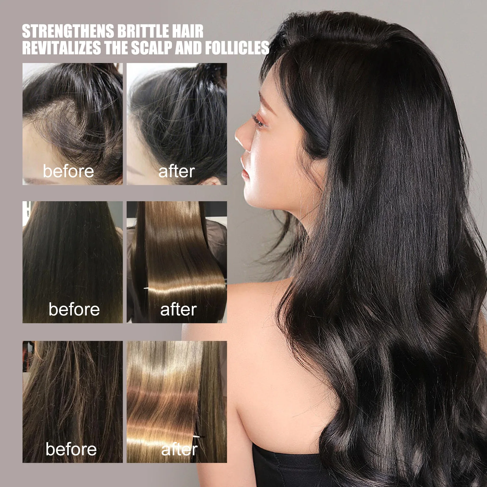 شامبو روزماري مضاد لتساقط الشعر يحفز تجديد الشعر وتعزيز جذور فروة الرأس وتنقية التحكم في الزيت شامبو مغذي مهدئ