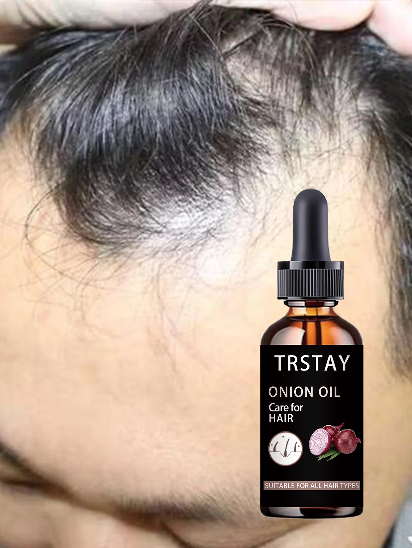 Moisturizing Intensive Curly Hair Treatment Deeply Hydrates Repairs Damaged Hair Boosts Elasticity Creates Soft Thick Dandruff F - Image 2