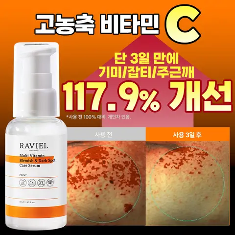 미백 기미 잡티 이별 세럼 비타민 C 순삭 3일 잡티 이별 세럼 멀티비타민 잡티 & 기미 케어 세럼 50ml / 기미 잡티케어 화이트닝