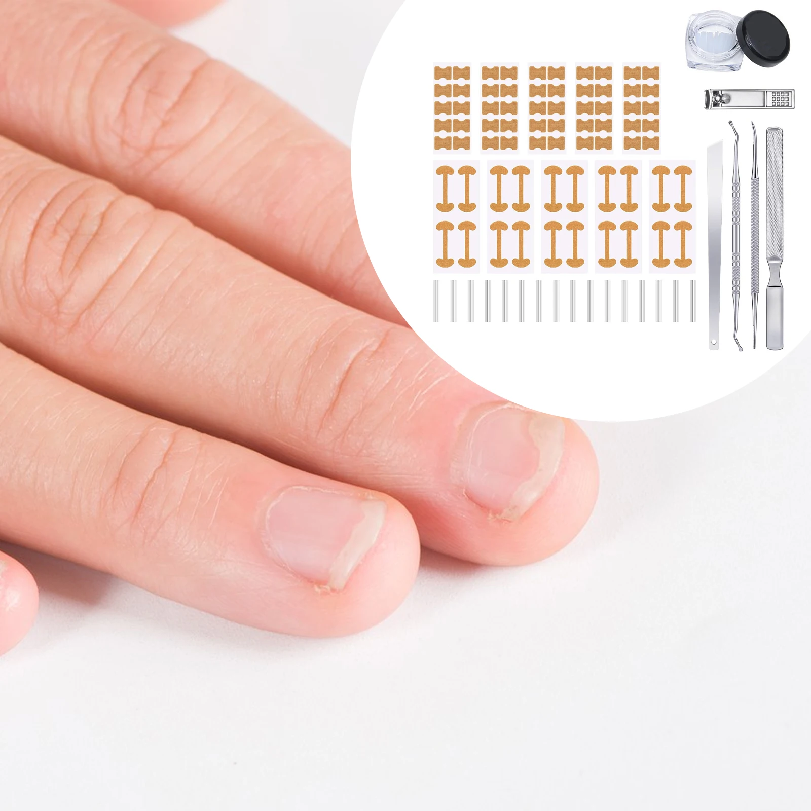 Ingrown Nail Correction Kit Nail Art Tools Elastic Breathable Ingrown Fingernail Corrector Professional Efficient For All Nail