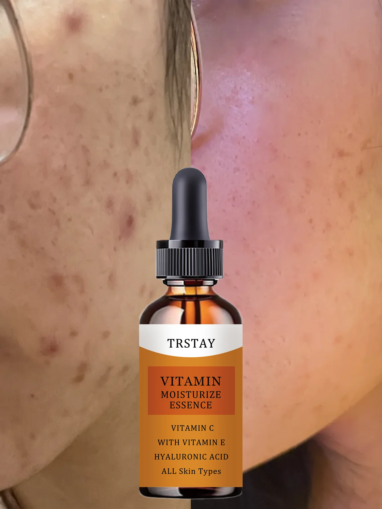 Hydrating Lightweight Nourishing Oil for Dehydrated Skin Deep Moisture Repair Serum with Natural Ingredients for Dry Sensitive S - Image 4