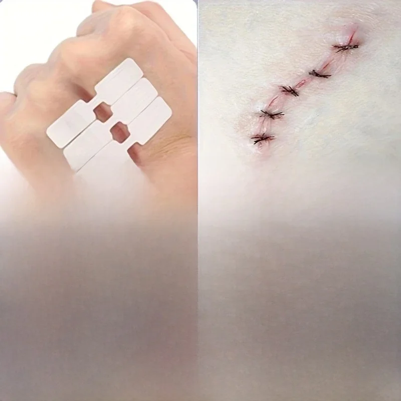 Bande adhésive jetable pour plaies en plein air, Patch de Suture pour premiers secours, bande d'aide, Patch de Suture rapide d'urgence, 10 à 50 pièces