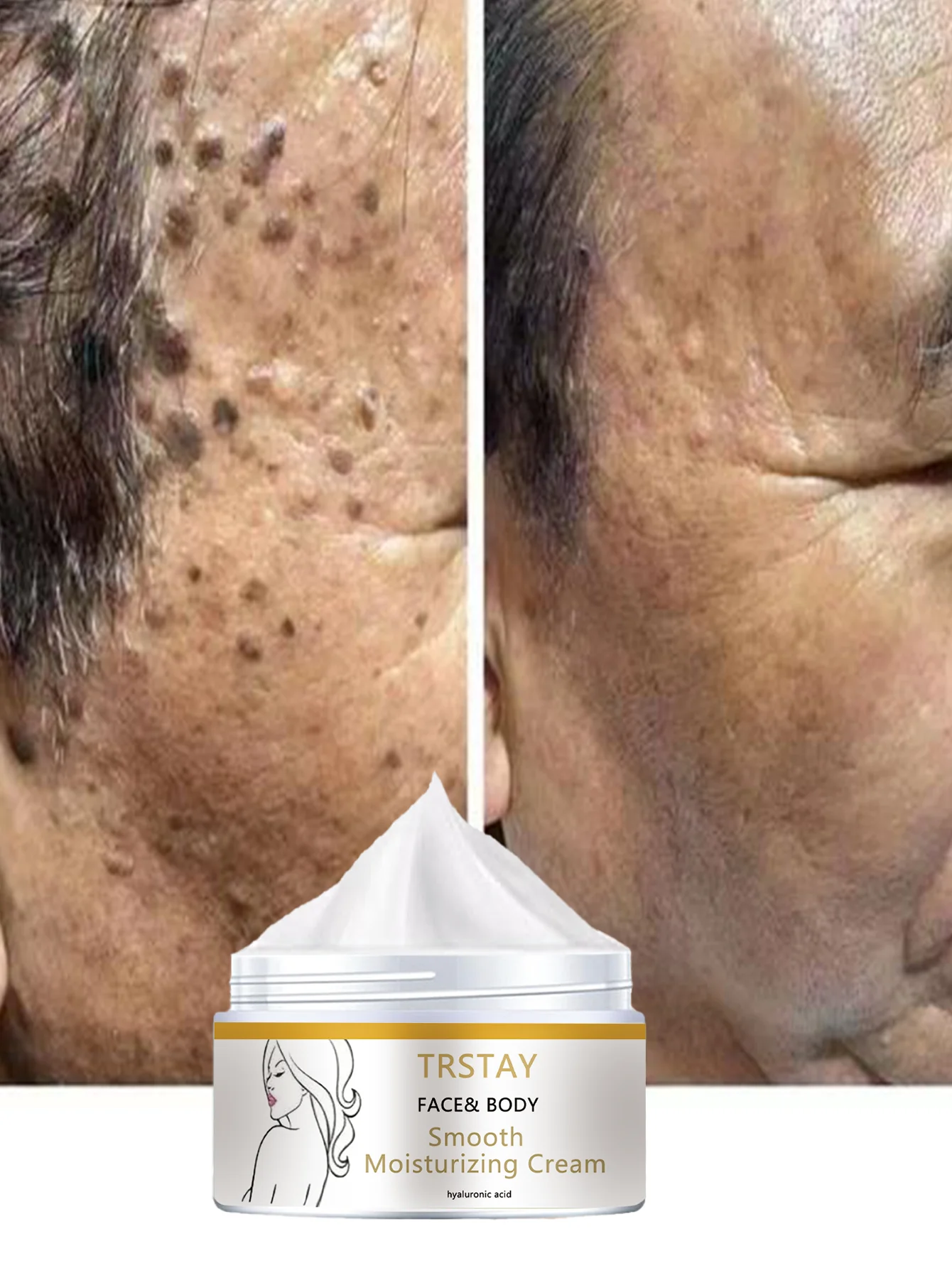 

Осветляющая увлажняющая сыворотка с точечным осветляющим кремом для лица для уменьшения сухих линий, регулирует масло, стягивает поры и укрепляет кожу.