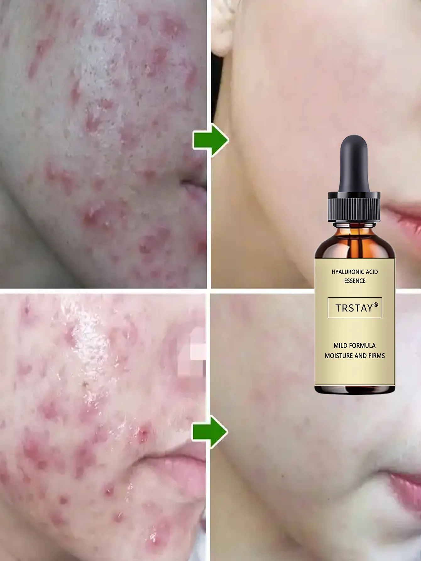 Hydrating Water Light Facial Oil for All Skin Types Deep Moisturizing Nourishing Serum with Natural Extracts Lightweight Non Gre