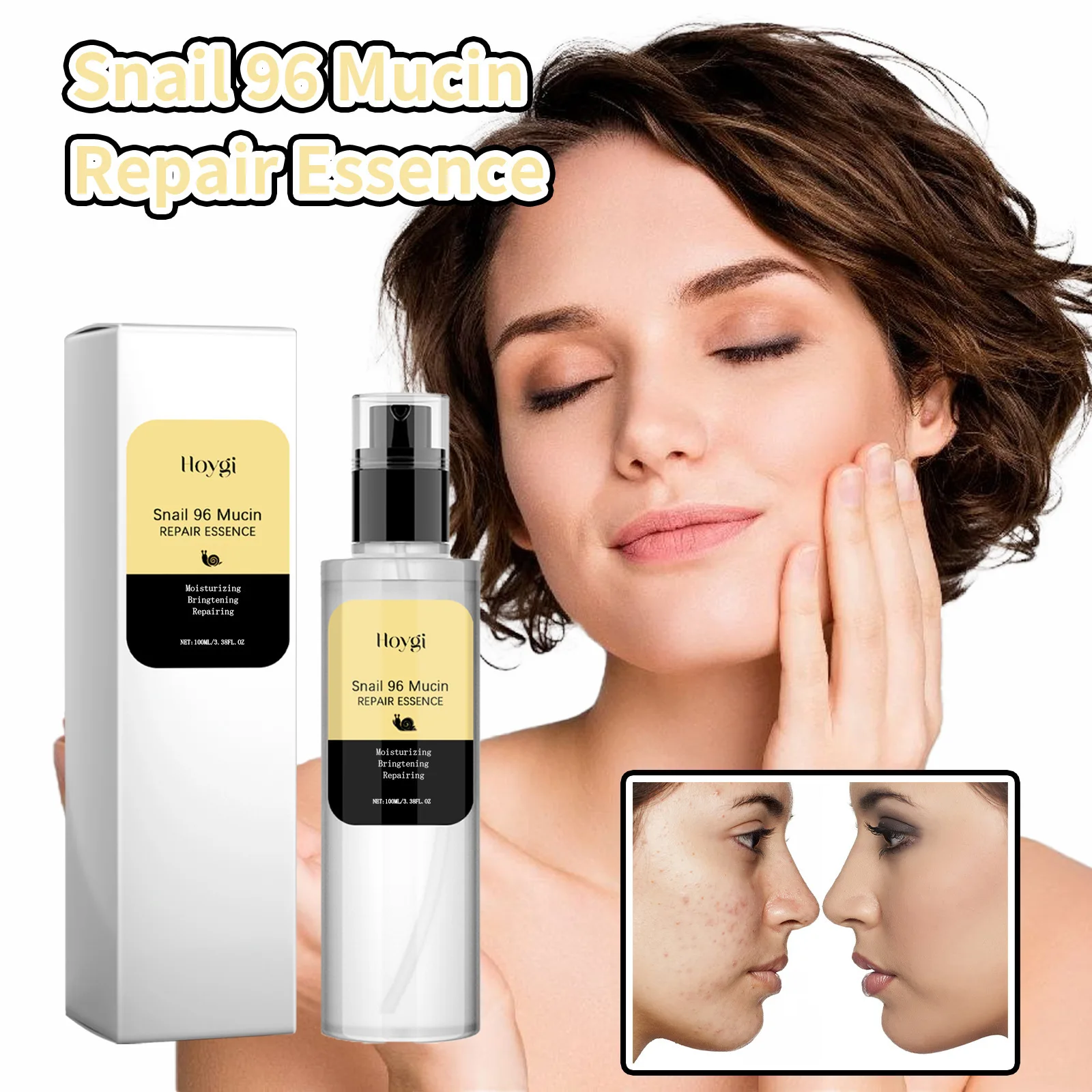 

100 мл Hoygi Snail Collagen Essence, уменьшение морщин, укрепляющее, увлажнение, эластичность, коррекция темных тонов, быстро впитывающая сыворотка