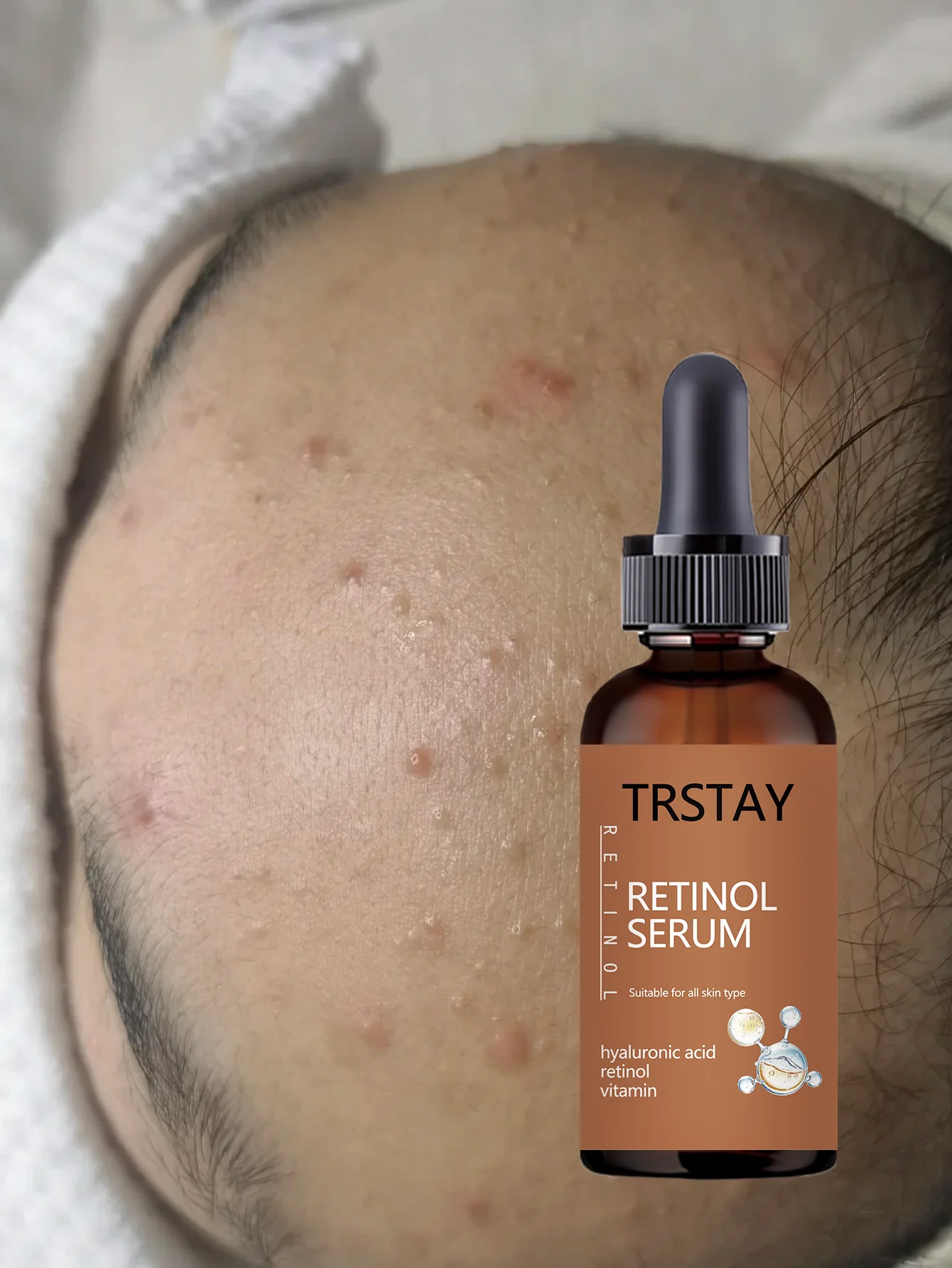 Hydrating Facial Oil for All Skin Types 24H Moisture Lock Nourishing Serum Instant Relief Essential Hydration Skin Care Treatmen - Image 2