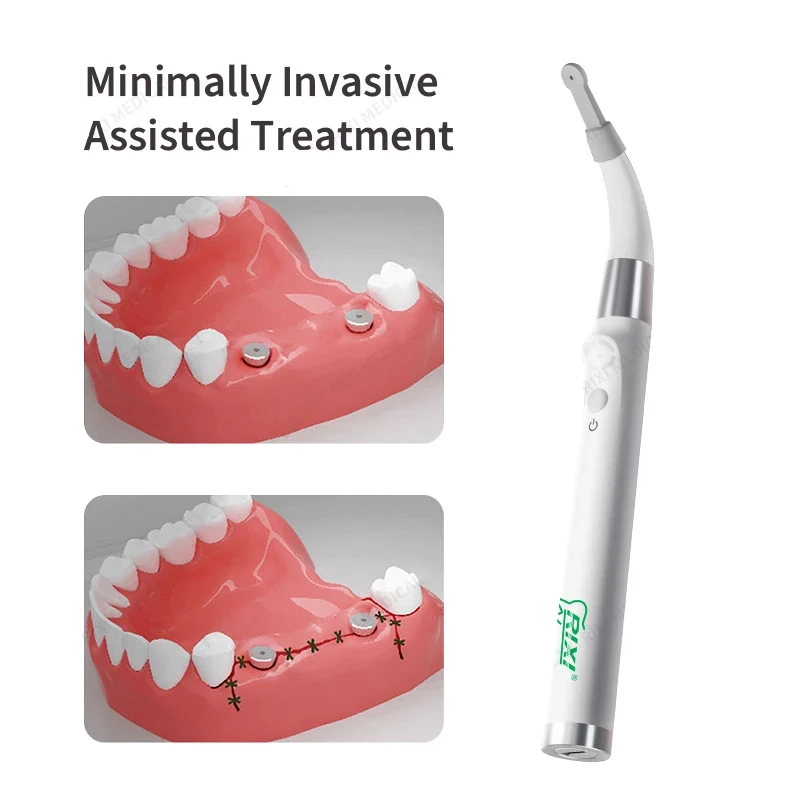 Equipo Dental RIXI para Conductos Radiculares, Localizador de Implantes Dentales, Destornillador de Alta Precisión, Herramienta Detectora de Localización