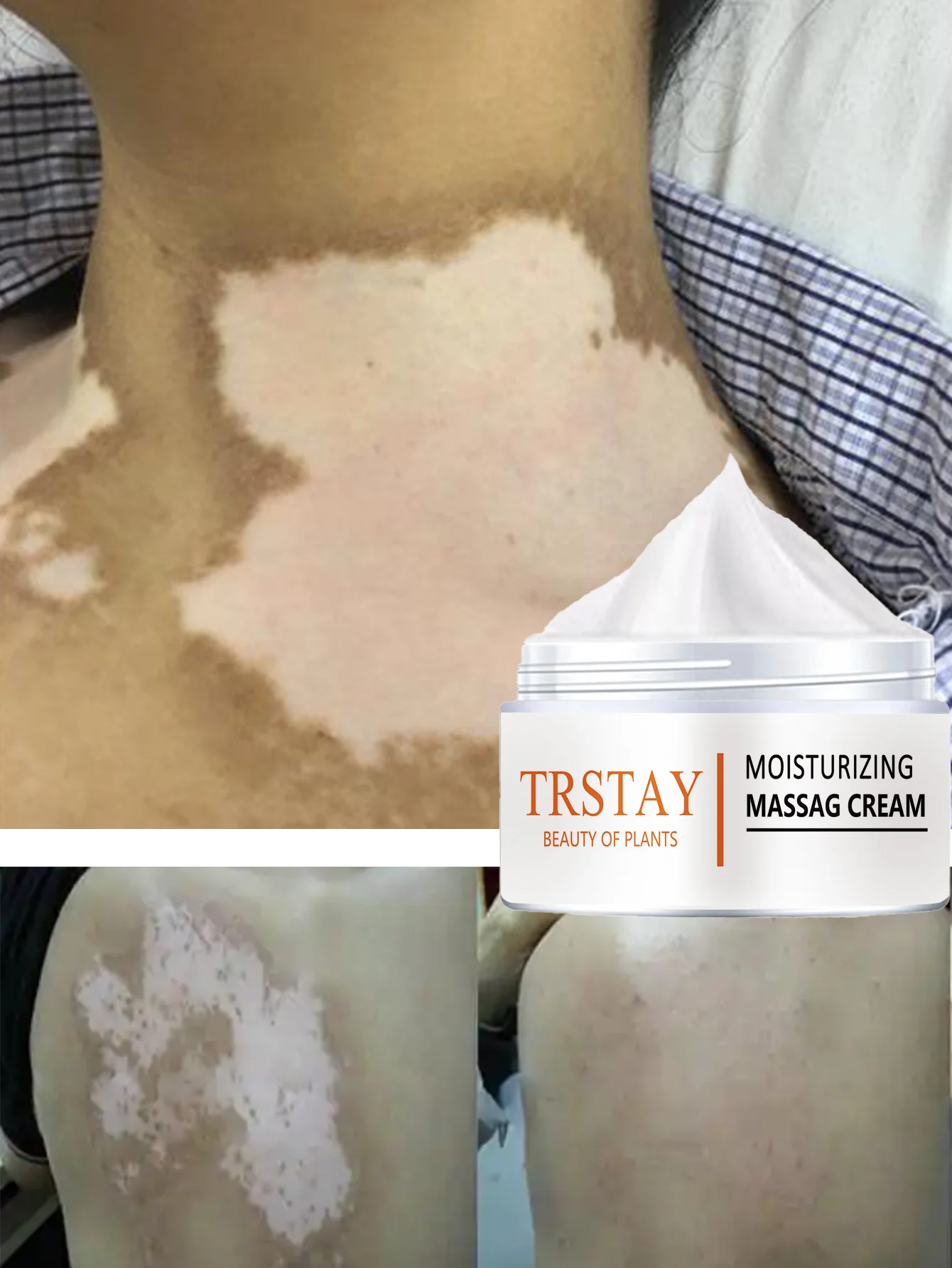 

Увлажняющий отбеливающий крем для тела, блокирует баланс влаги. Текстура кожи. Нежная, гладкая, полупрозрачная, нежная формула для мягкой радии.