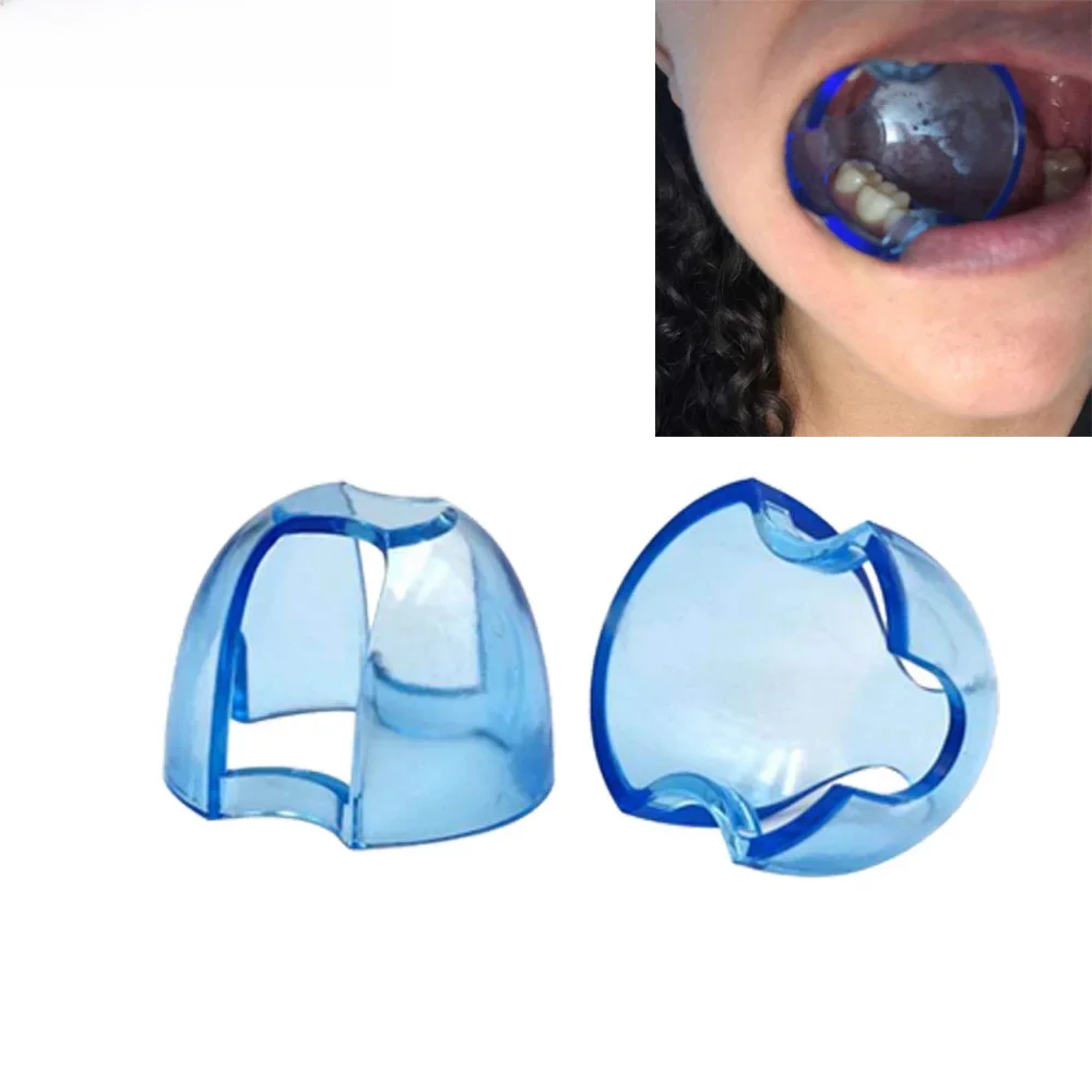 Écarteur de joue intra-oral dentaire, ouvre-bouche, blanchiment des dents pour dents antérieures et postérieures