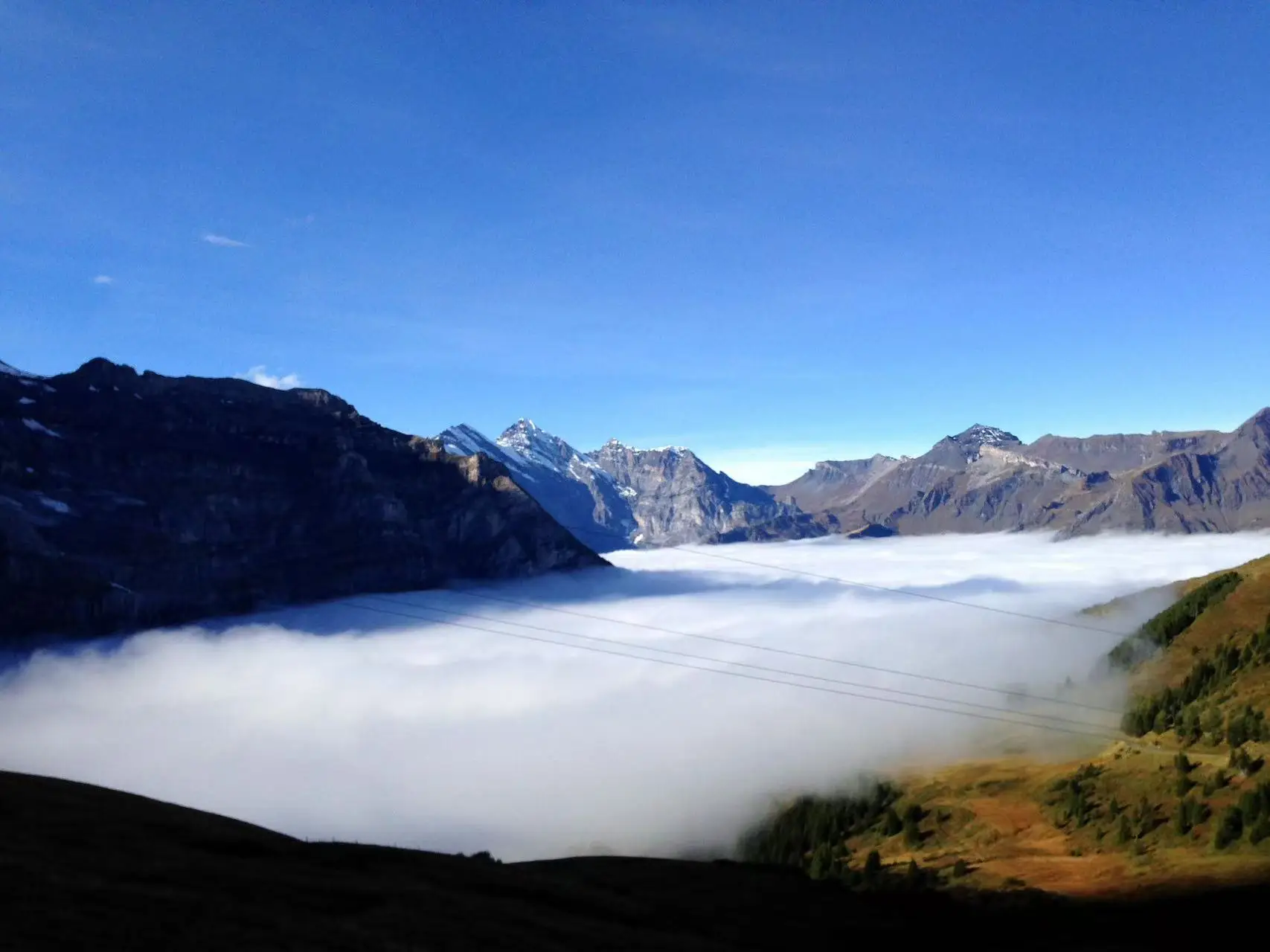 

EMSzero Body Sculpting Muscle High-Intensity Focused Electromagnetic Energy Sculpt Body Muscle Contractions Burn Fat Build