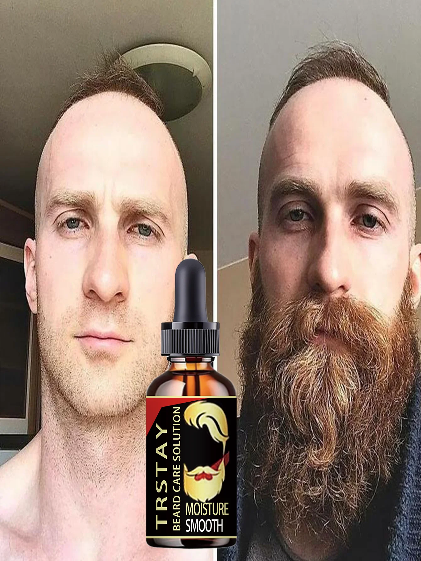 Premium Beard Oil For Men Moisturizes Prevents Dryness Cracking Promotes Thicker Fuller Beard Growth With Essential Nutrients St - Image 4