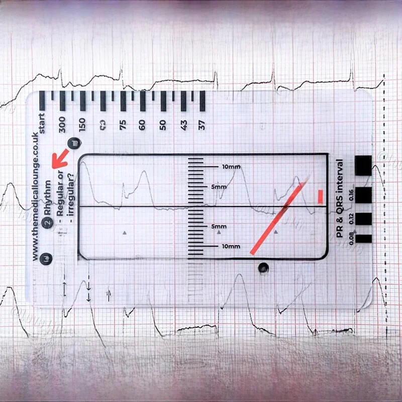 Règle à 7 étapes pour interprétation ECG/ECG, guide de référence portable avec gaine, outil d'urgence