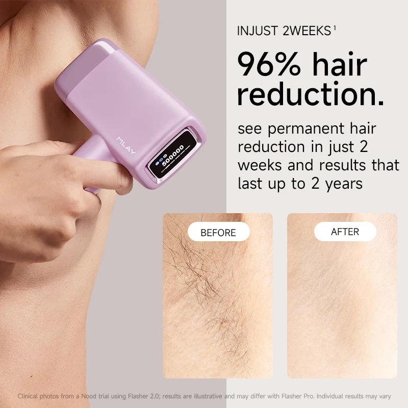 Thumbnail 3 - #42 Best IPL Devices to Buy In 2026