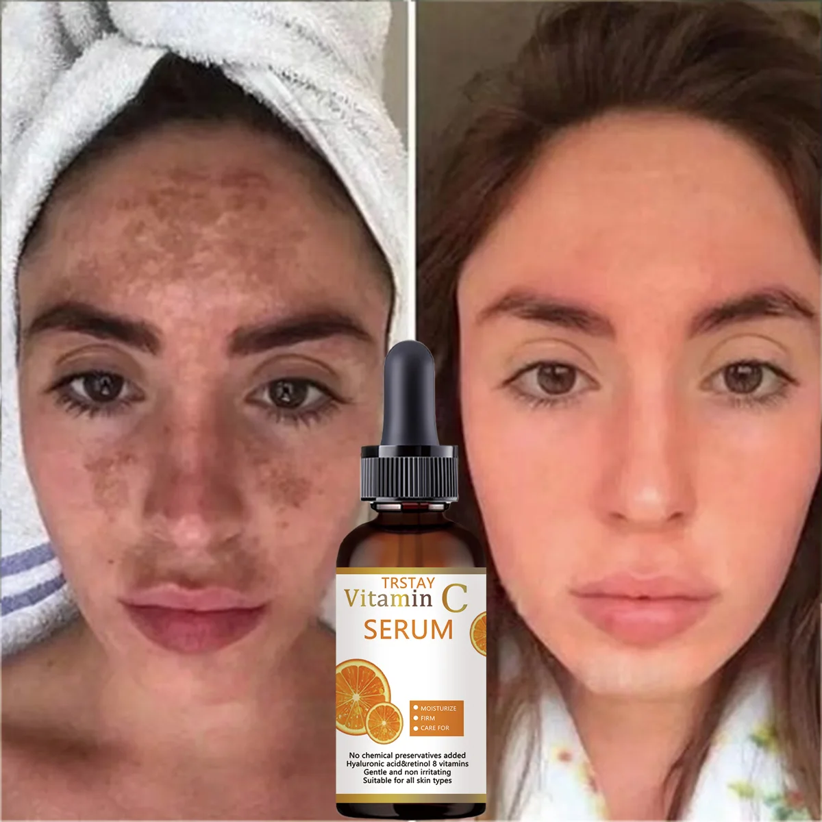 Moisturizing anti aging serum for fine lines and dry lines reduction spot lightening essence liquid nourishes smooth glossy skin - Image 4