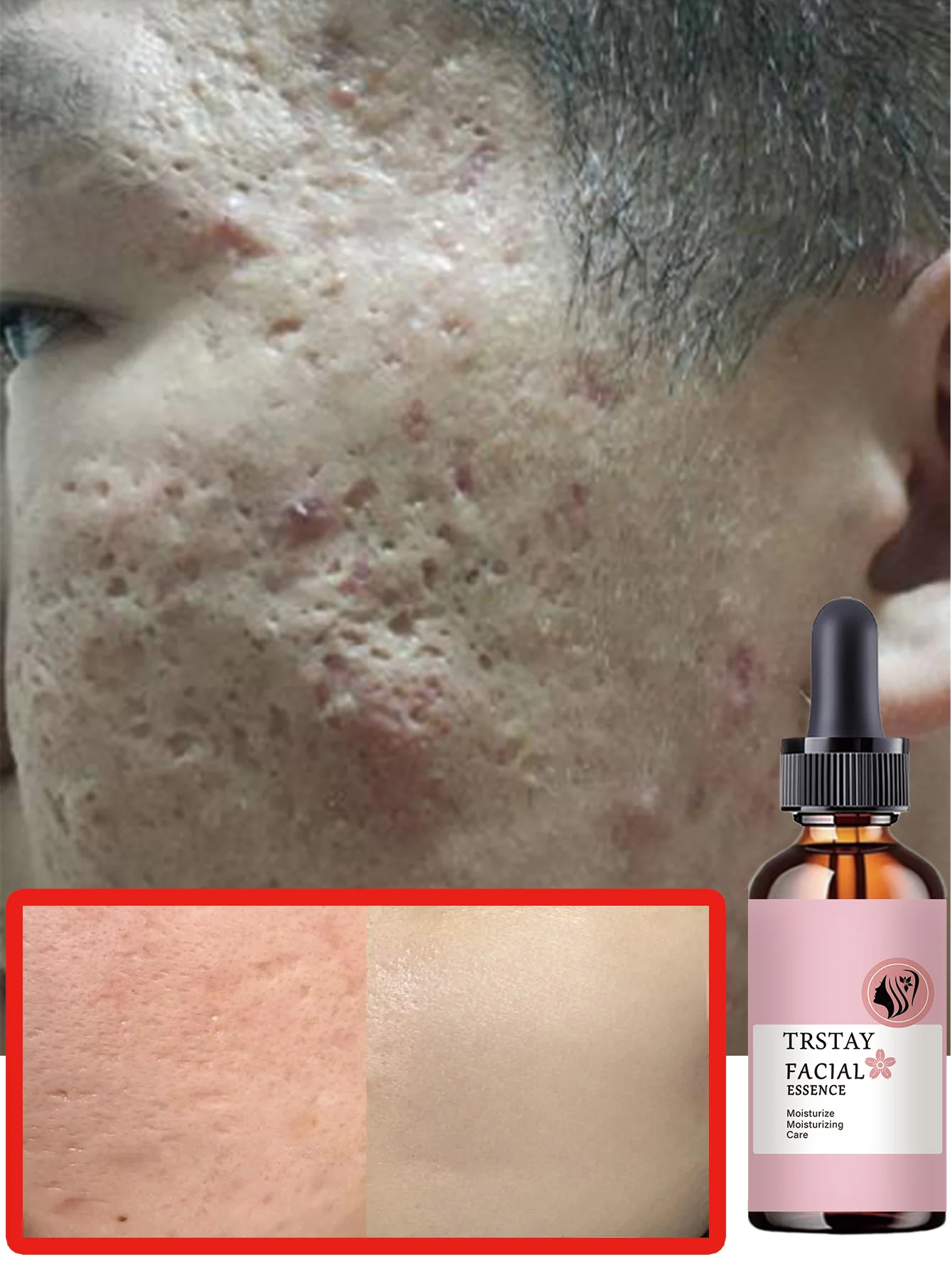 Moisturizing brightening serum for skin tone improvement hydration and firming dual effects with radiance for sagging skin care - Image 4