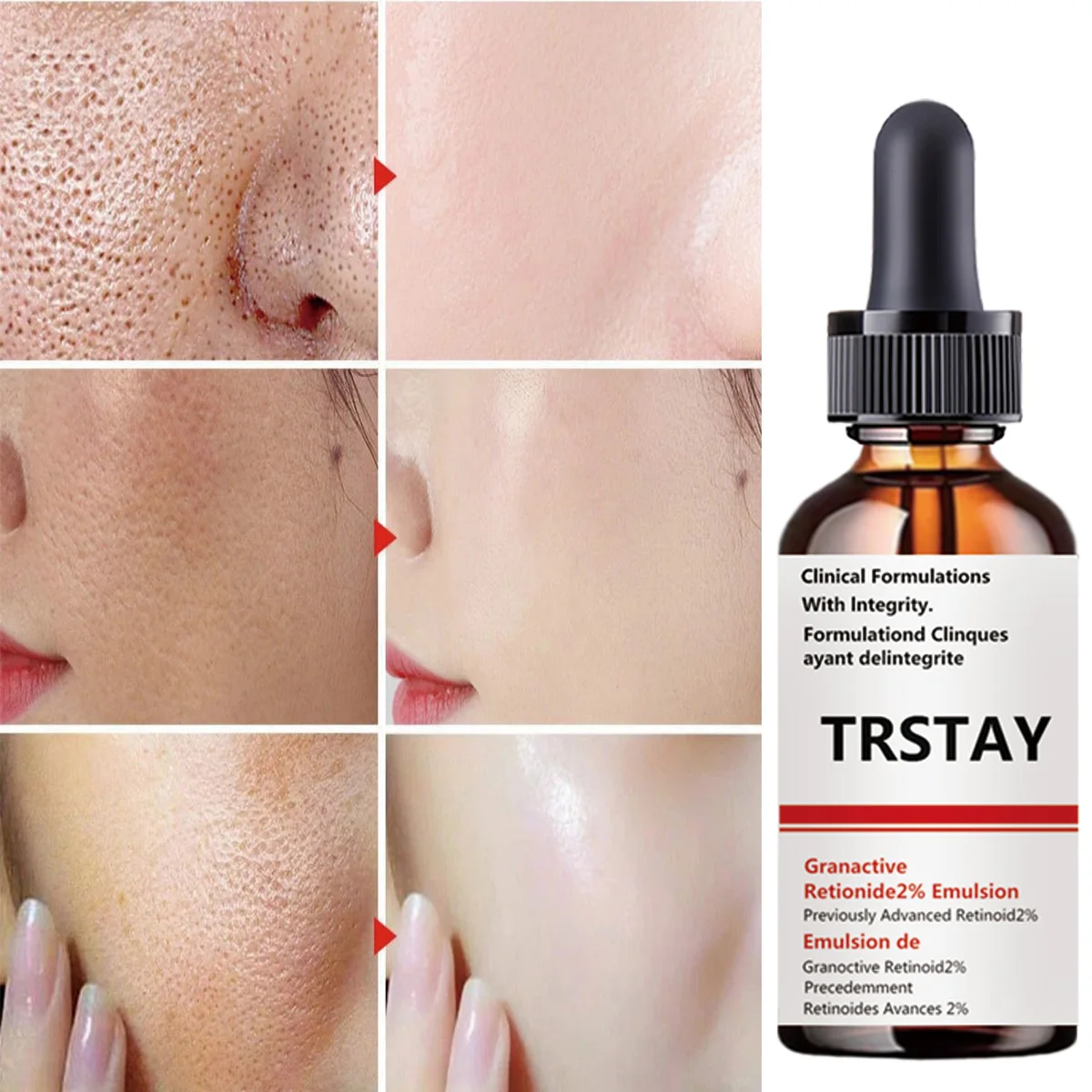 

Увлажняющая восстанавливающая эссенция с несколькими эффектами, устраняющая пятна, улучшающая тусклость, лифтинг, подтяжка кожи, осветление цвета лица, увлажнение, питает красный цвет