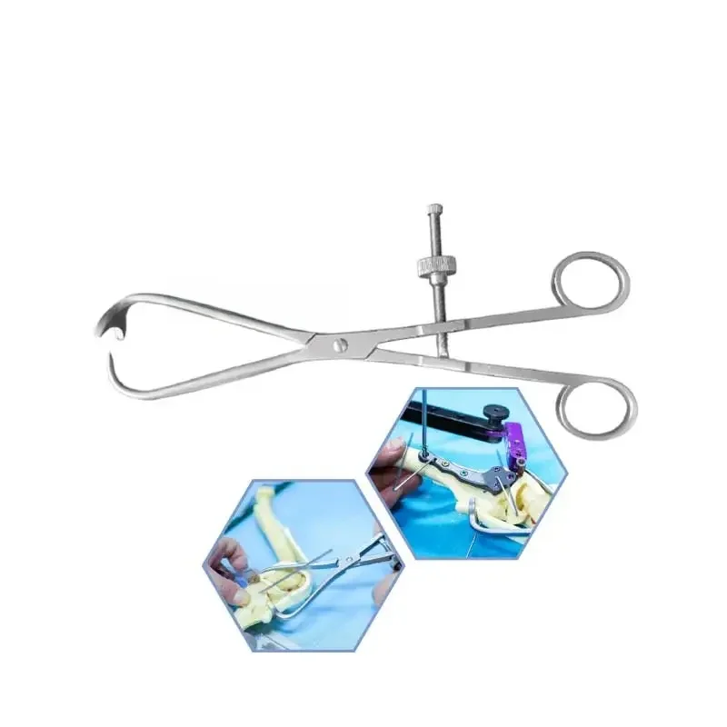 Pince de réduction TPLO alpes, instruments orthopédiques vétérinaires, outils pour animaux de compagnie, vis de verrouillage, plaque osseuse chirurgicale
