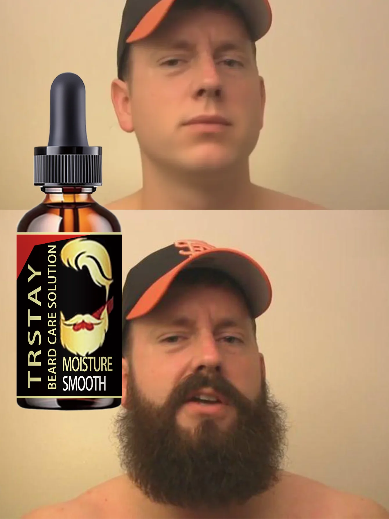 Premium Beard Oil For Men Moisturizes Prevents Dryness Cracking Promotes Thicker Fuller Beard Growth With Essential Nutrients St - Image 6