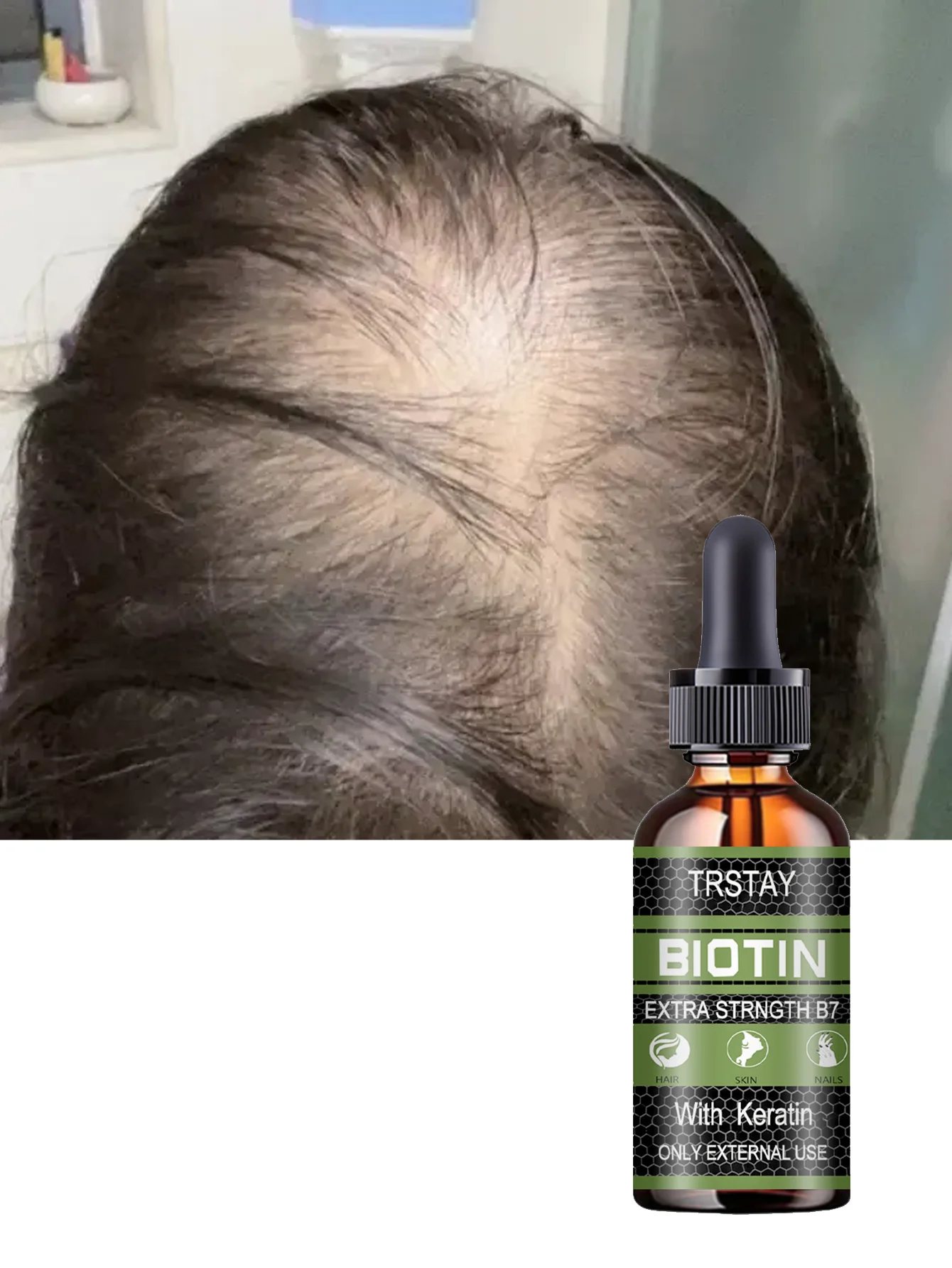 Moisturizing Hair Treatment Oil for Nourishing and Growing Your Hair Reduce Split Ends and Frizz for Thicker Fuller Healthier Lo - Image 4