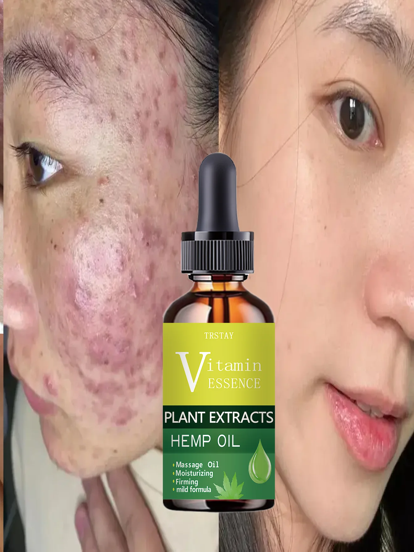 Hydrating Spot Removing Anti Wrinkle Brightening Firming Lifting Facial Serum for Radiant Youthful Skin with Deep Hydration and