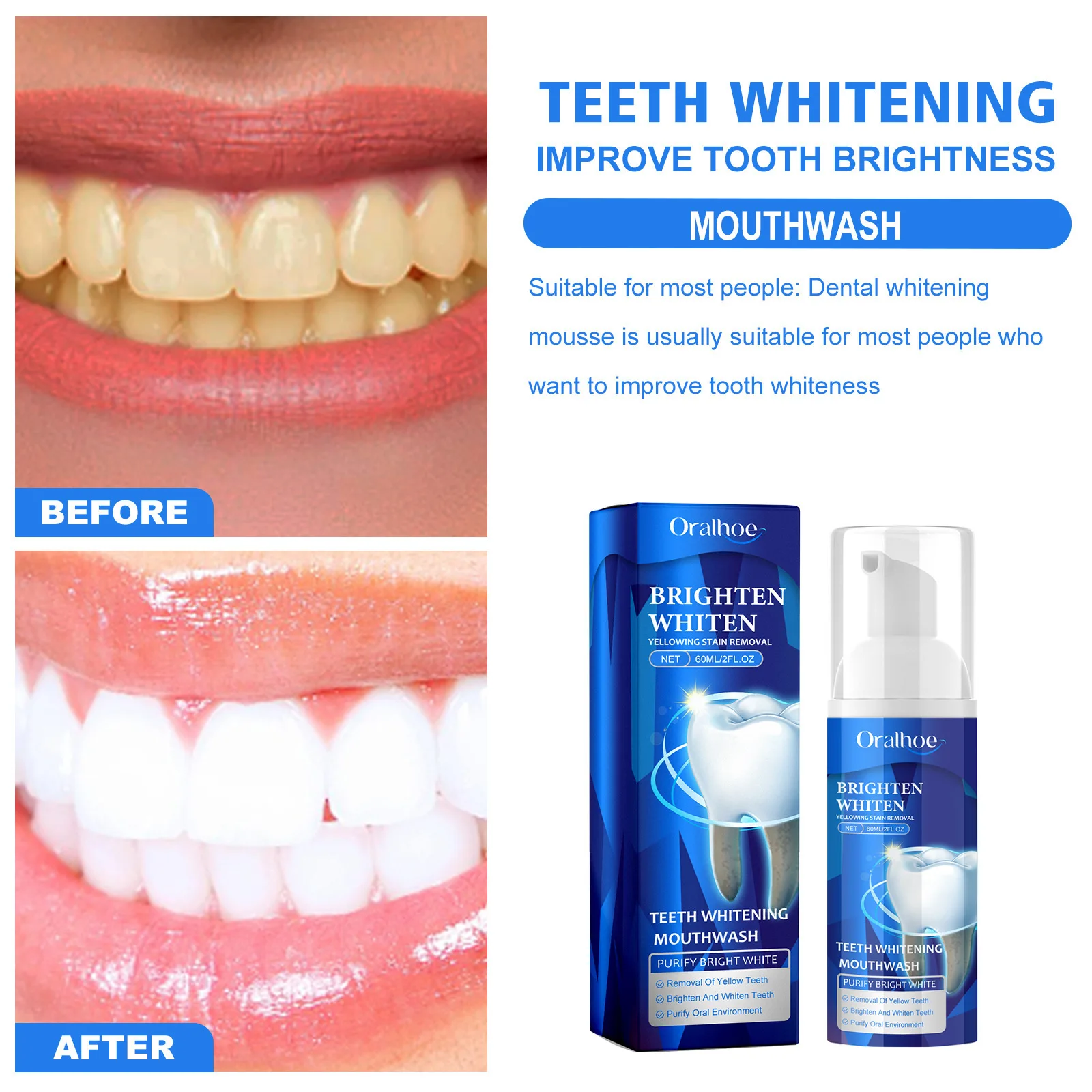 Oralhoe 60ml Teeth Whitening Mouthwash Mousse Brighten Repair Gum Stains Reduce Yellowing Teeth Fresh Breath Oral Care Mouthwash