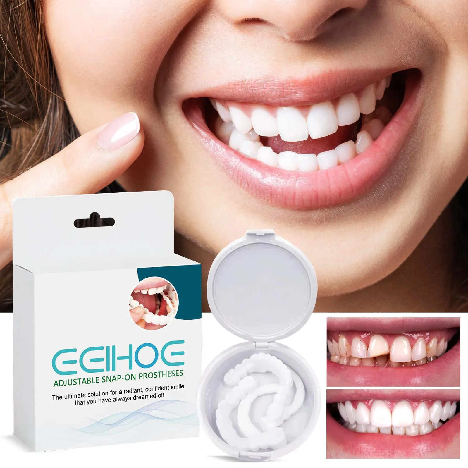 Eelhoe 1pair Whiten Fake Tooth Cover Snap On Oral Hygiene Adjustable Temporary Tooth Instant Confident Smile Veneers Teeth Brace