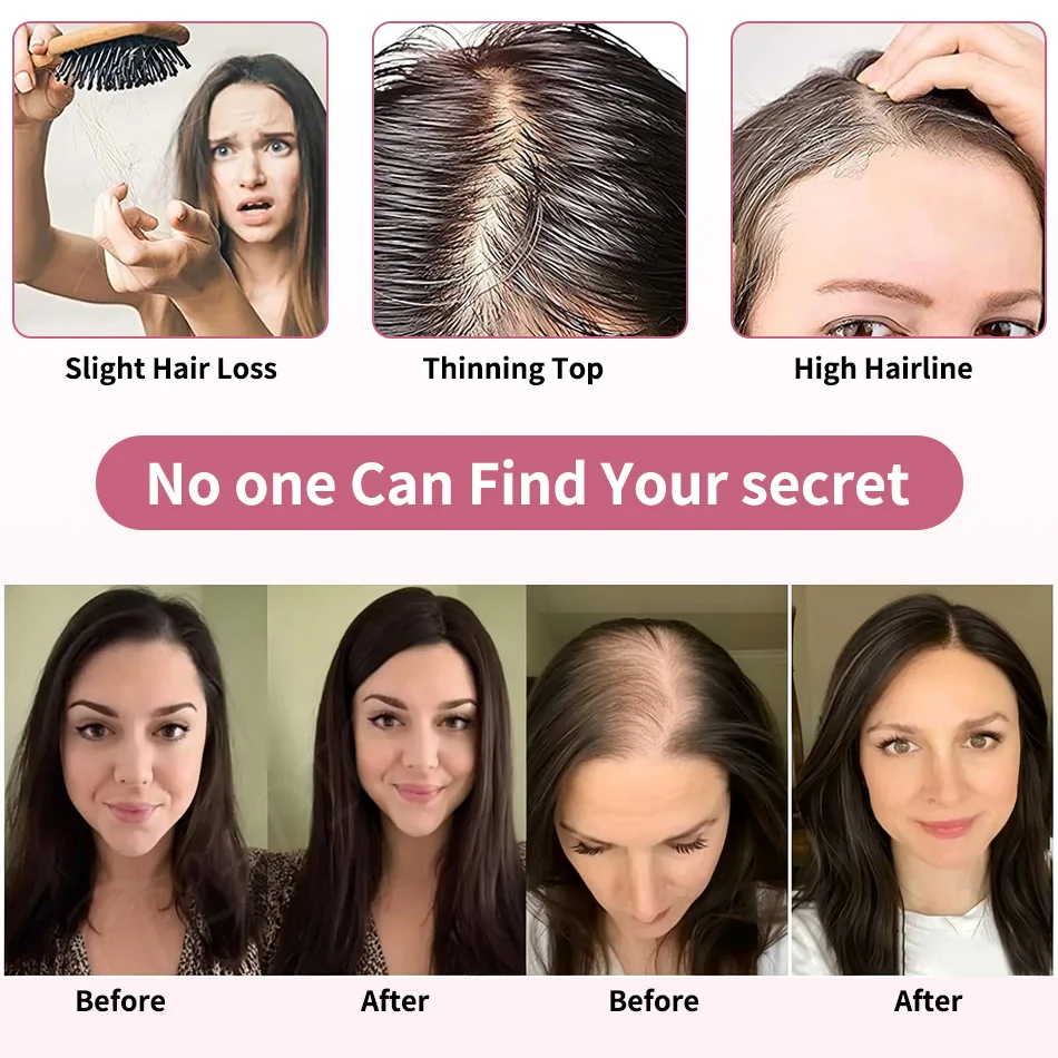 Real Human Hair Toppers for Women Clip In Straight 9x14cm 12 Inch #2 Medium Brown Breathable Mesh Base for Thinning Hair Add Vol