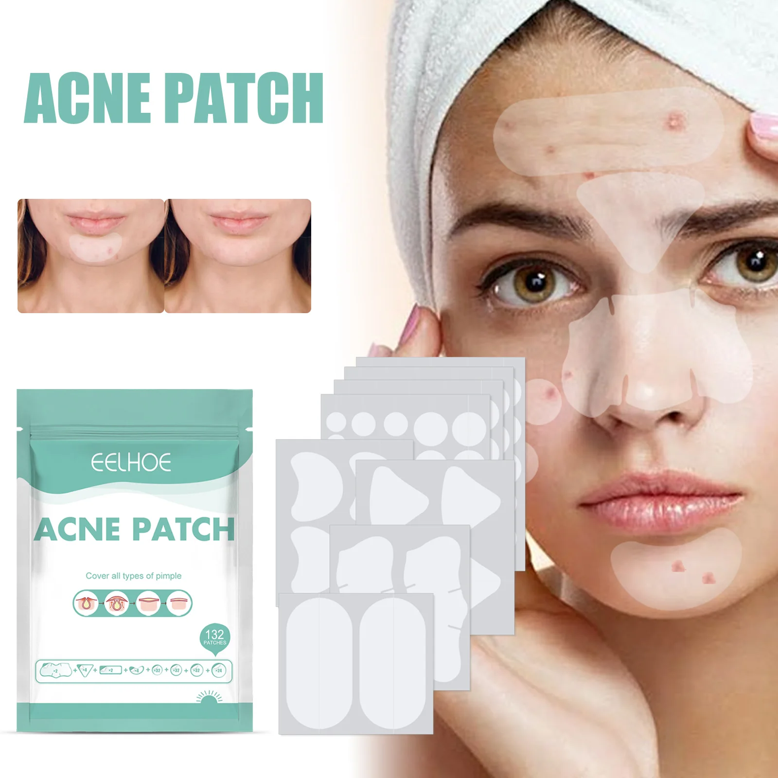 Eelhoe 132 Stück Akne Pickel Patches Hydrokolloid Mitesser Entferner Unsichtbarer Concealer Reparatur Makel Heilung Gesicht Akne Maske Patch