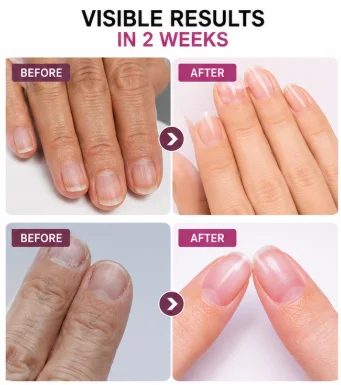 Gray-Toned Grape Purple Nail Strengthener, Natural Quick-Drying, No-Bake Required, Long-Lasting Shine for Nails, Protects Thin Nails