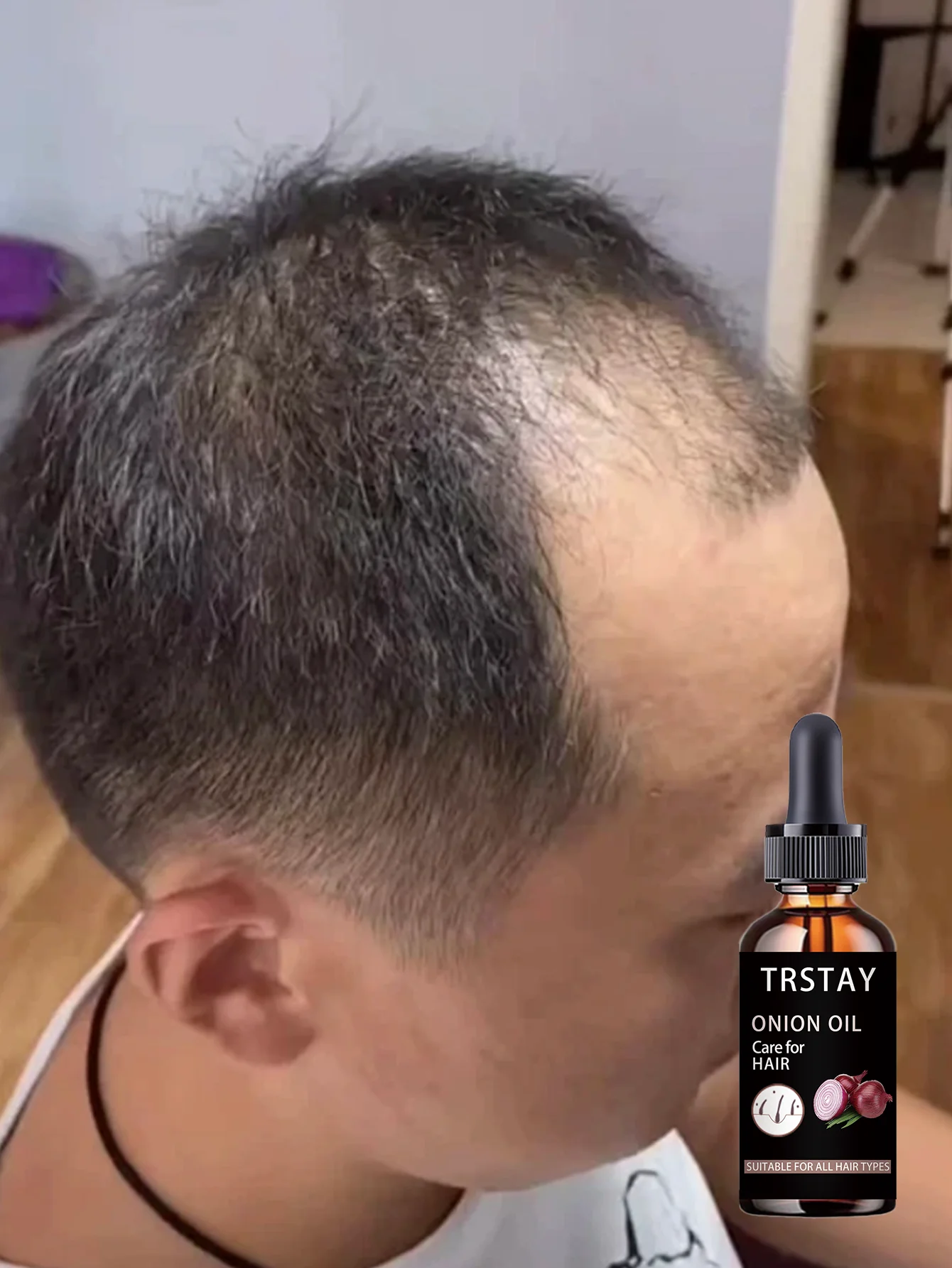 Moisturizing Intensive Curly Hair Treatment Deeply Hydrates Repairs Damaged Hair Boosts Elasticity Creates Soft Thick Dandruff F - Image 6