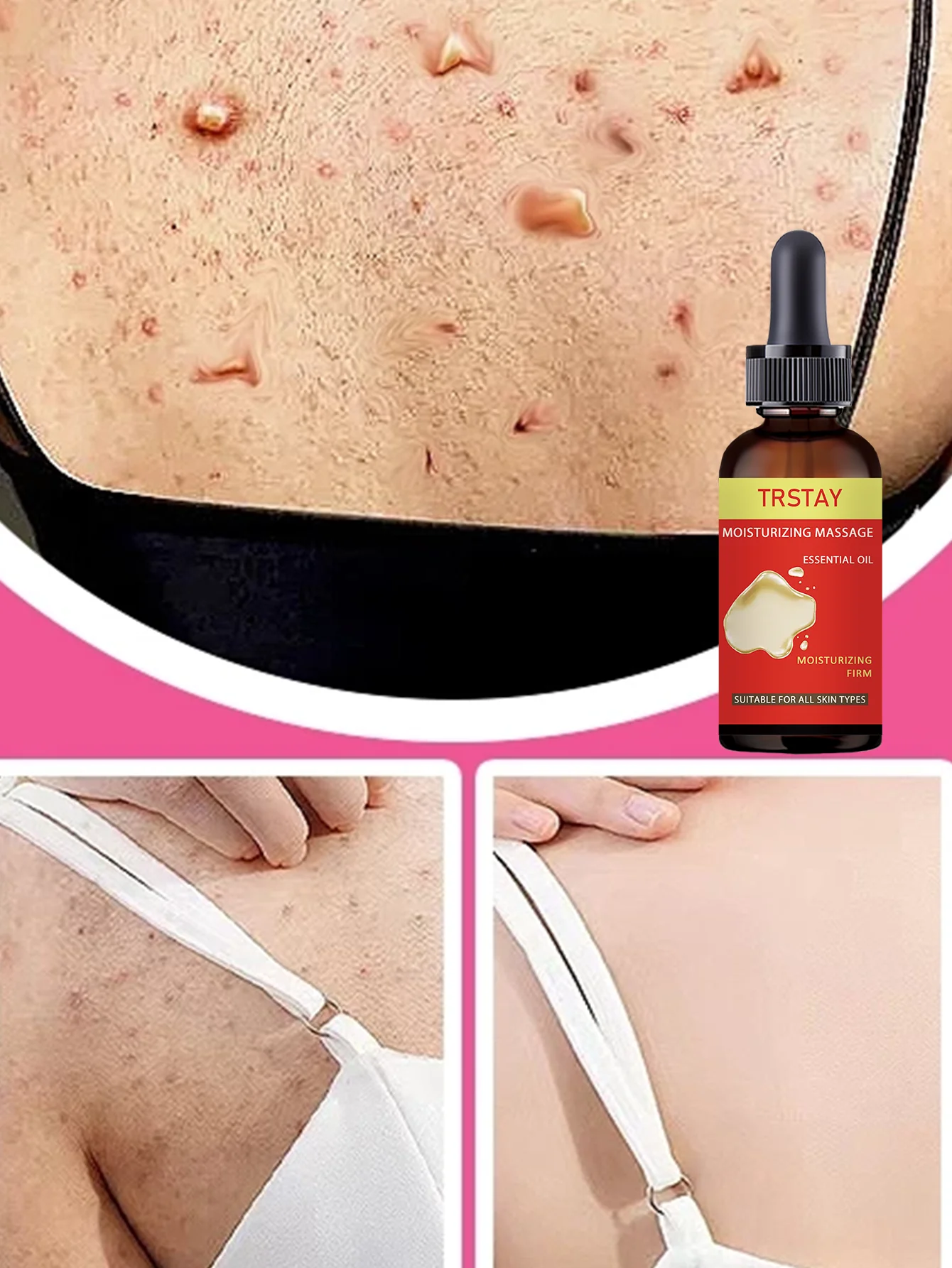 

Buttocks Essential Oil Tightening Smoothing Moisturizing Lifting Oil for Uneven Skin Tone Improvement Translucent Skin Restorati