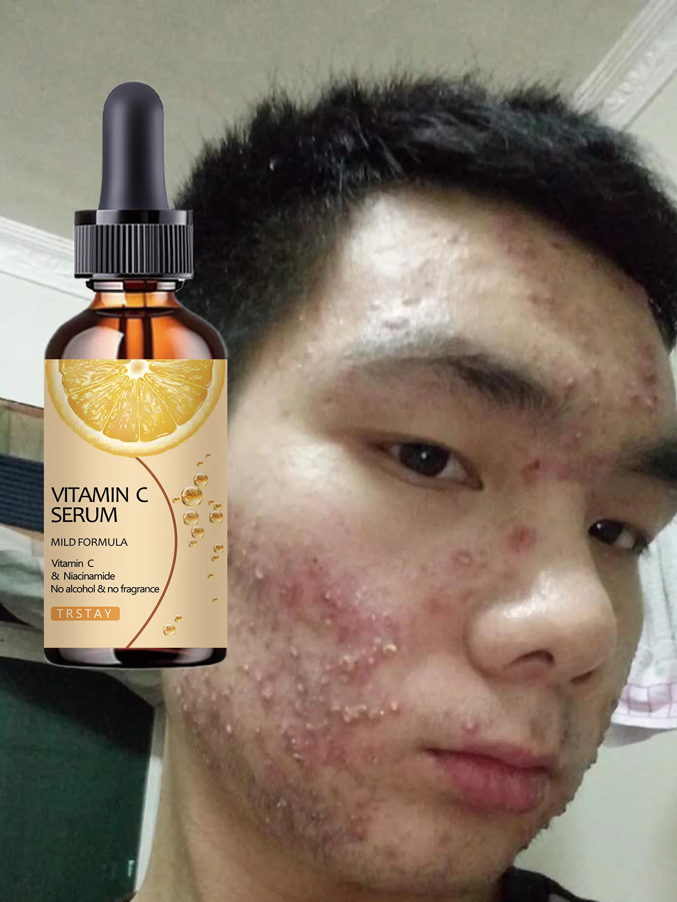 Hydrating Lightweight Serum Deeply Moisturizes Enhances Skin Firmness Creates Plump Youthful Skin Smooth Soothing Treatment for - Image 4