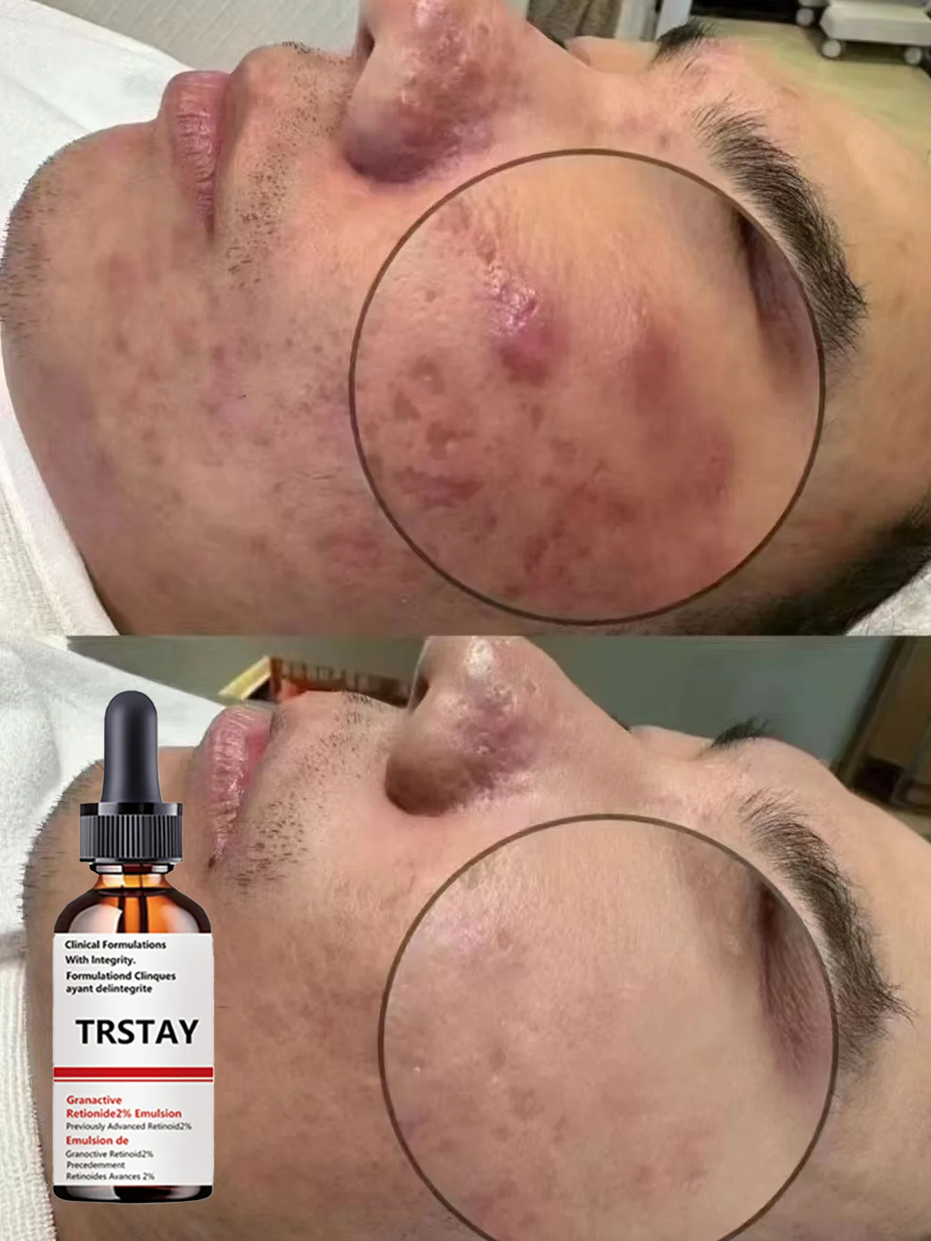 Hydrating Anti Aging Serum Brighten Complexion Reduce Wrinkles Smooth Texture Even Tone Revitalize Glow Multi Effect Repair Esse