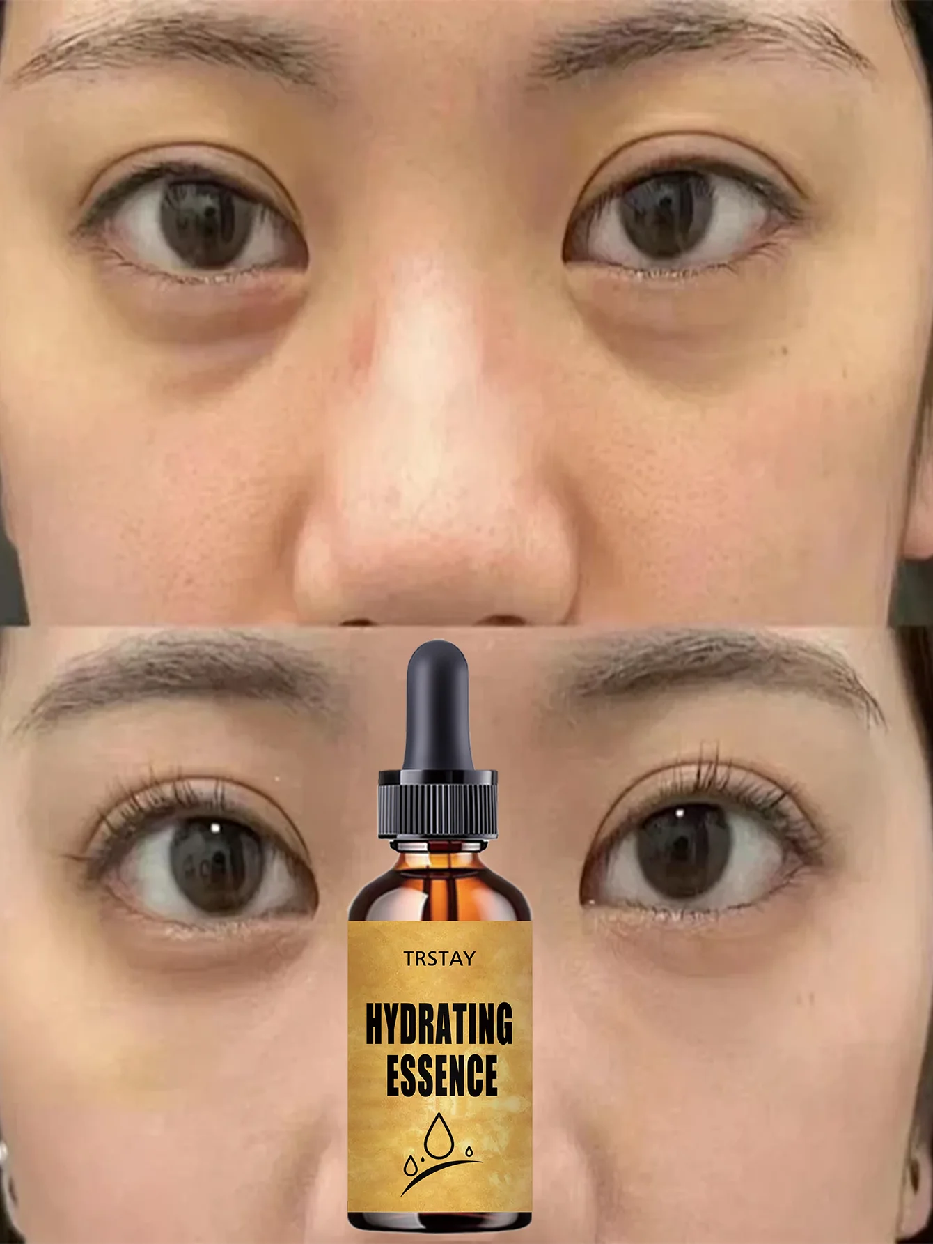Moisturizing Vitamin E Eye Oil for Brightening and Smoothing All Skin Types Eye Care Solution to Hydrate and Nourish Delicate Ey