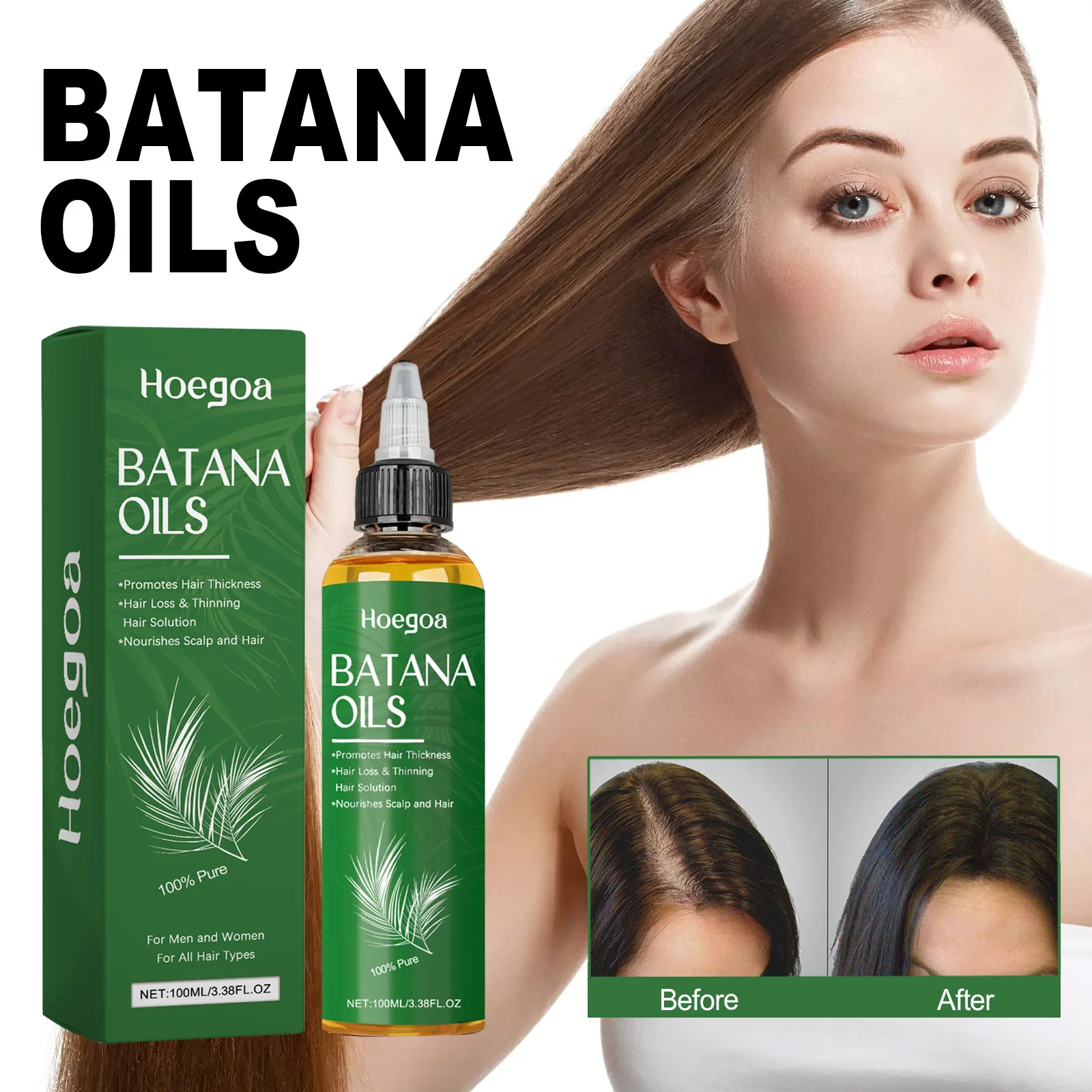 Hoegoa Hair Growth Serum Hair Strengthening Oil Stimulates Scalp Hair Care Essential Oil 100% Pure Organic Batana Oil