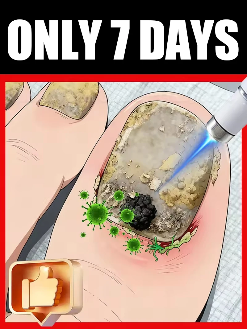 

Generation-2 Laser Says Goodbye To Bad Manicure In 7 Days