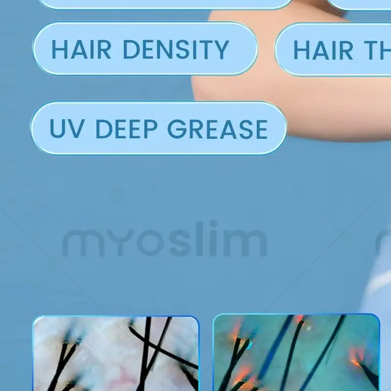 

Цифровой 3D-анализатор кожи Magic Mirror: интеллектуальный прибор для диагностики с ИИ-изображением