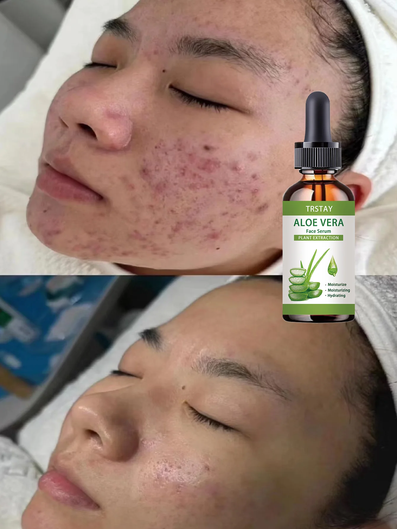 Hydrating Spot Lightening Anti Wrinkle Essence with Intelligent Moisturizing Technology for Sculpting Delicate Skin and Soothing