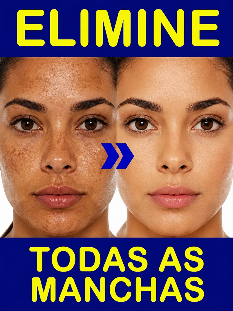 Strong Dark Spot Corrector Sun Spot Remove Serum Melanin Inhibitor Anti Blemish Glow Skin Lightening