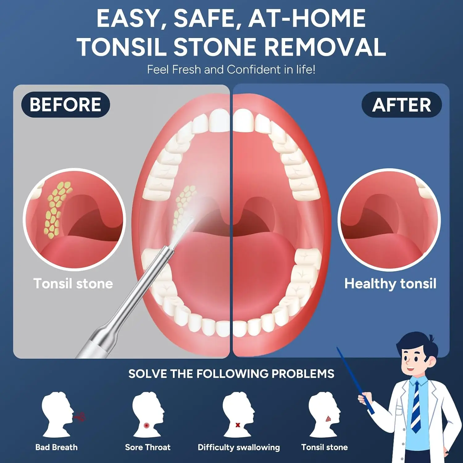 Tonsil Stone Remover with Camera - Upgraded Visual Tonsil Stone Removal Kit