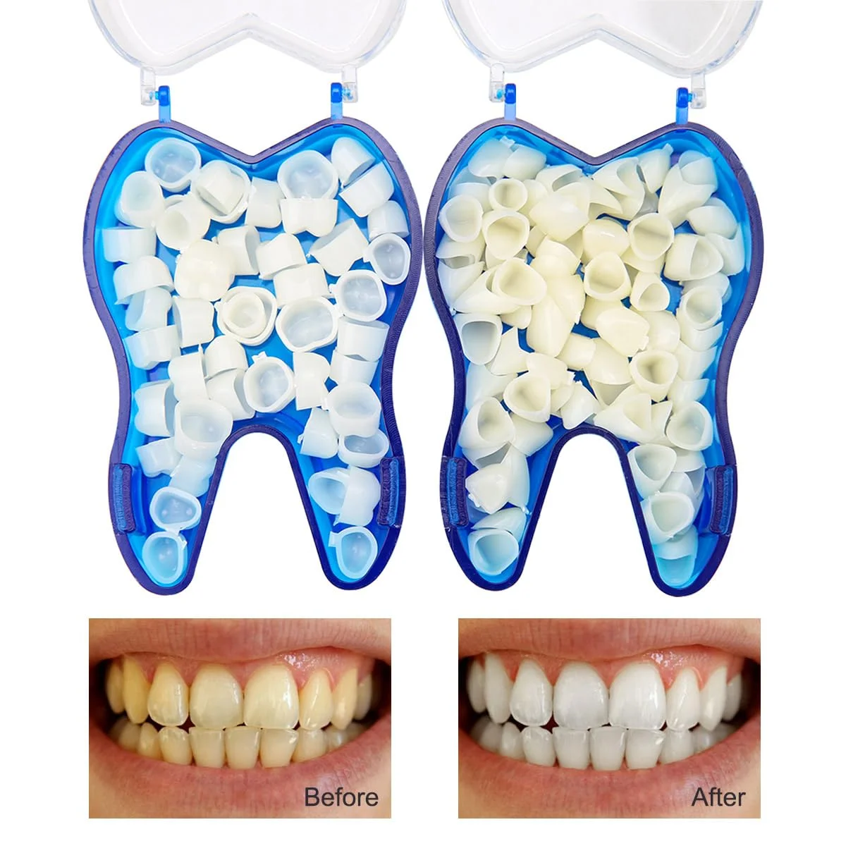 50 Pcs/Box Dental Temporary Crown Kit Anterior Front Molar Posterior Teeth Veneers Dentistry Tooth Whitening Tools