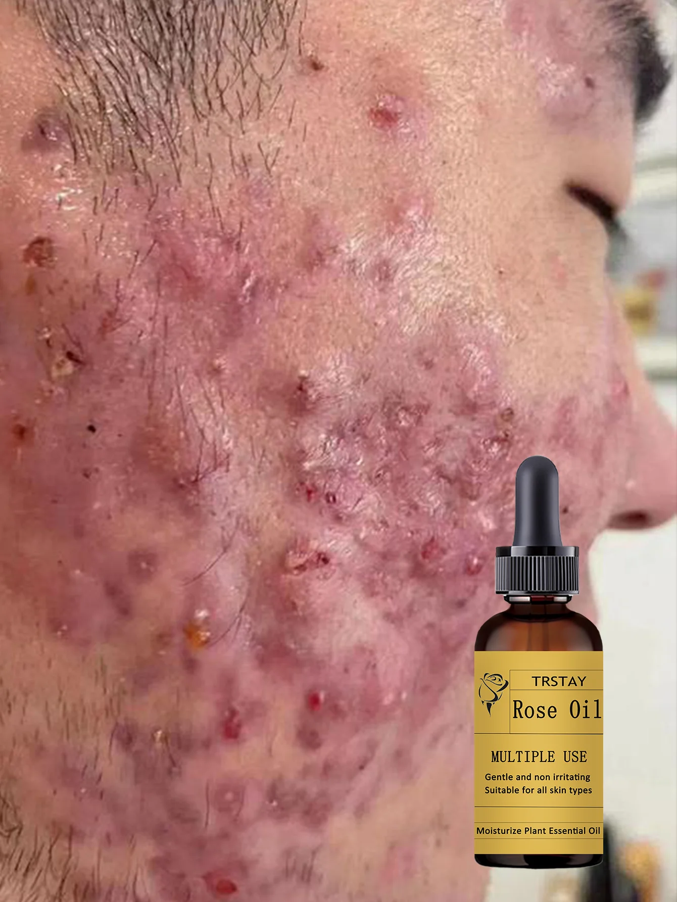 All-in-One Hydrating Serum for All Skin Types Fast-Absorbing Formula to Simplify Your Skincare Routine with Deep Moisture and No - Image 3