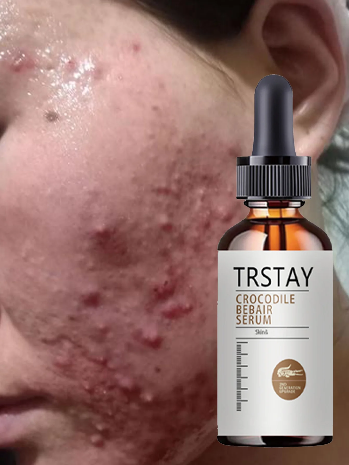 Moisturizing Essential Oil for Skin Hydration and Firming with Natural Extracts to Improve Elasticity and Reduce Wrinkles for Yo - Image 6