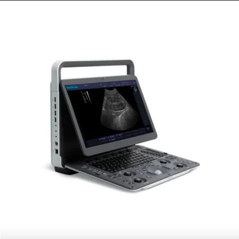 Sono Scape A6V Expert E1V | Quality Ultrasound Equipment