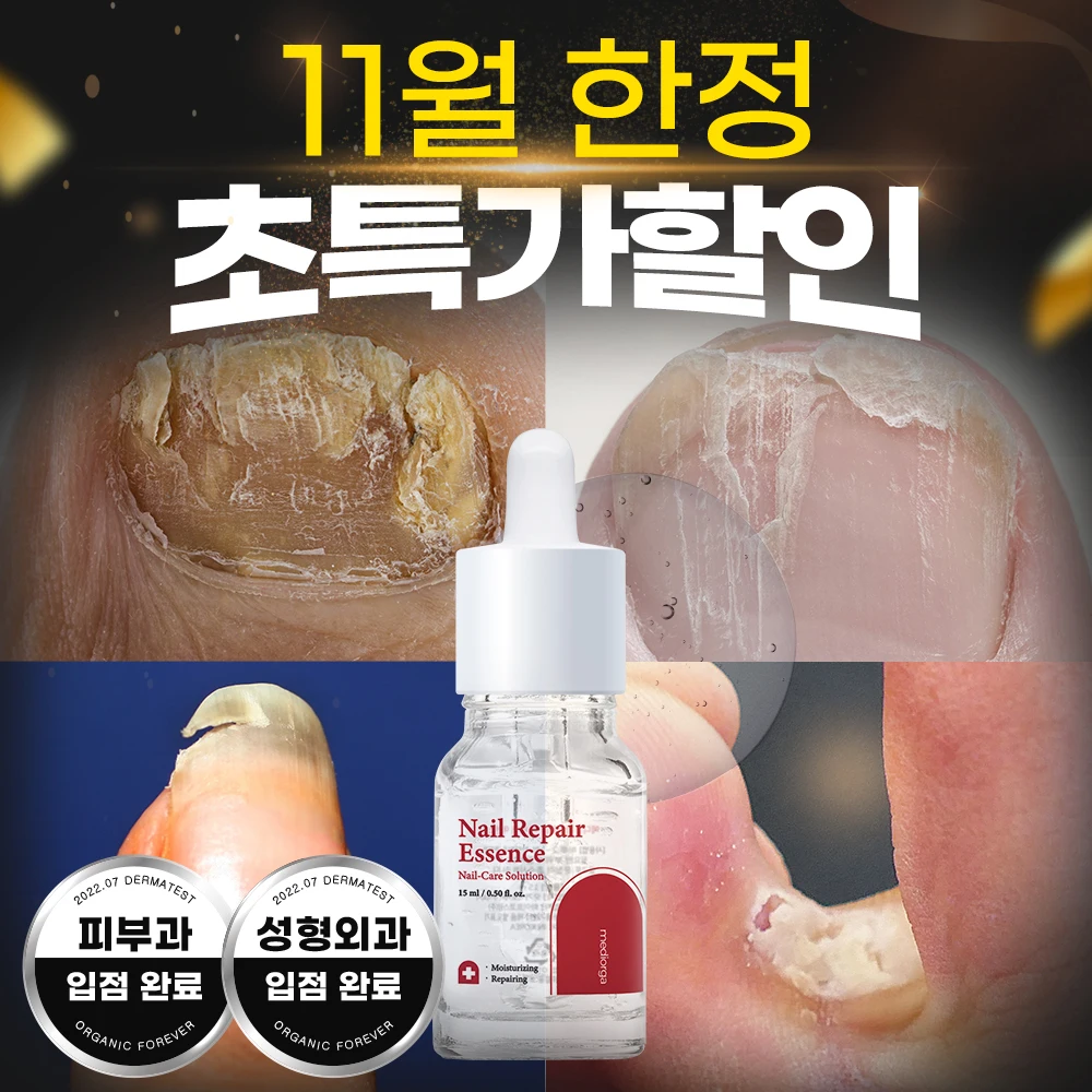 [Special Limited Sale Offer] Mediorga Nail Repair Essence: Intensive Care Serum for Fungal Infections and Nail Issues