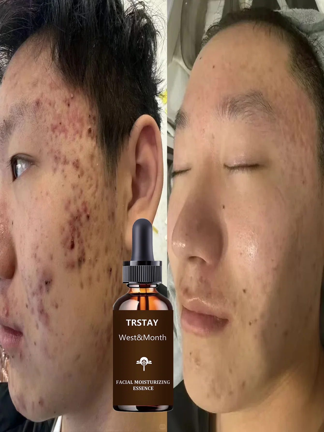 Deeply Lock Moisture Anti Wrinkle Serum Tighten Sagging Skin Enhance Elasticity Youthful Contours Facial Treatment Smooth Skin C - Image 4